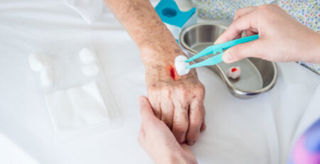 Surgical Wound Care at Home