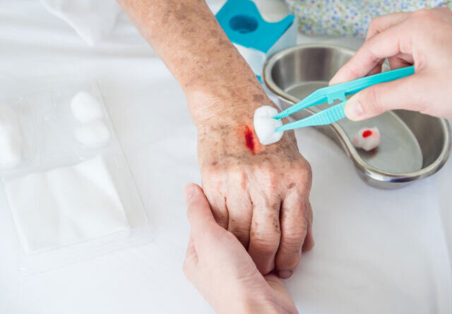 Surgical Wound Care at Home