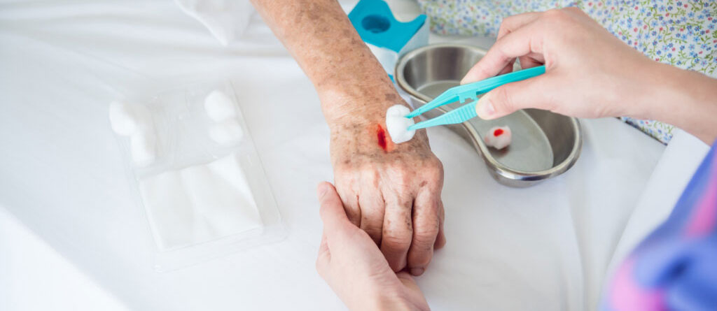 Surgical Wound Care at Home